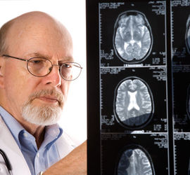 Využití magnetické rezonance ke včasné diagnostice sakroiliitidy u AS (ankylozující spondylitidy, morbus Bechtěrev)