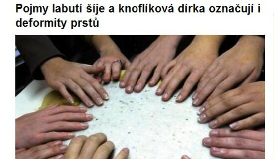 Pojmy labutí šíje a knoflíková dírka označují i deformity prstů