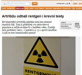 Artritidu odhalí rentgen i krevní testy