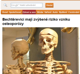 Bechtěrevici mají zvýšené riziko vzniku osteoporózy