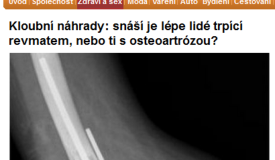 Kloubní náhrady: snáší je lépe lidé trpící revmatem, nebo ti s osteoartrózou?