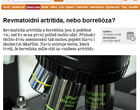 Revmatoidní artritida, nebo borrelióza?