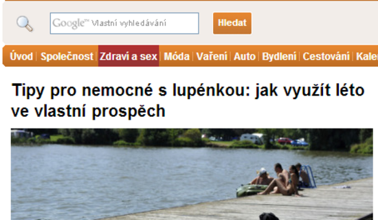 Tipy pro nemocné s lupénkou: jak využít léto ve vlastní prospěch