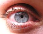 Revmatoidní artritida: ohrožen je i zrak 
